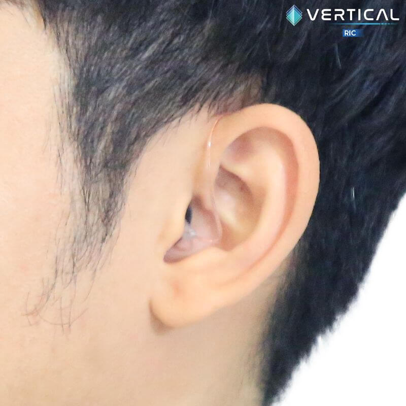 เครื่องช่วยฟัง VERTICAL RIC